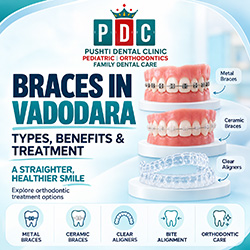 Braces in Vadodara: Types, Benefits & Treatment