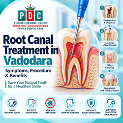Root Canal Treatment in Vadodara: Symptoms, Procedure & Benefits