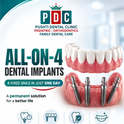 Why Professional Teeth Cleaning Is Important | PDC Dental Clinic