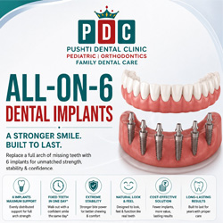 Why Professional Teeth Cleaning Is Important | PDC Dental Clinic