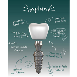 Dental Implants in Vadodara