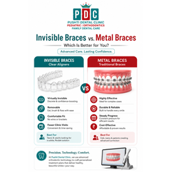 Invisible Braces vs Metal Braces in Vadodara